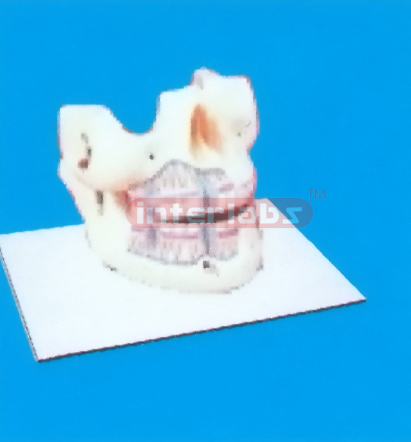 TYPE WHOLY MANENT TEETH MODEL